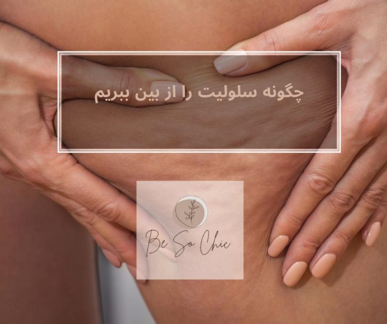 چگونه-سلولیت-را-از-بین-ببریم